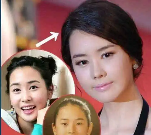 韩剧整容女明星_韩国整容女明星颜值变化_崔智友蔡琳尹恩惠刘仁娜刘荷娜韩恩贞金宣儿郑丽媛李多海朴诗妍